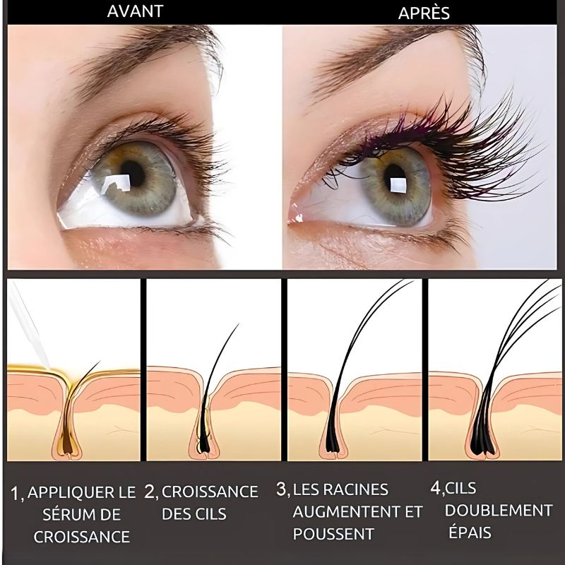CilsVita Boost - Sérum de Croissance Rapide des Cils en 7 Jours